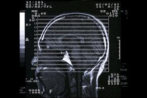 ファミリーで通える芦屋市の歯医者