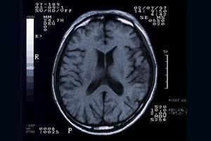 藤沢市で矯正を得意としている歯医者さん